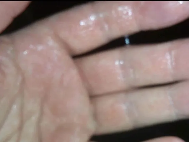 Gleitmittel: SPERMA