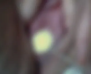 Kugelkette 2