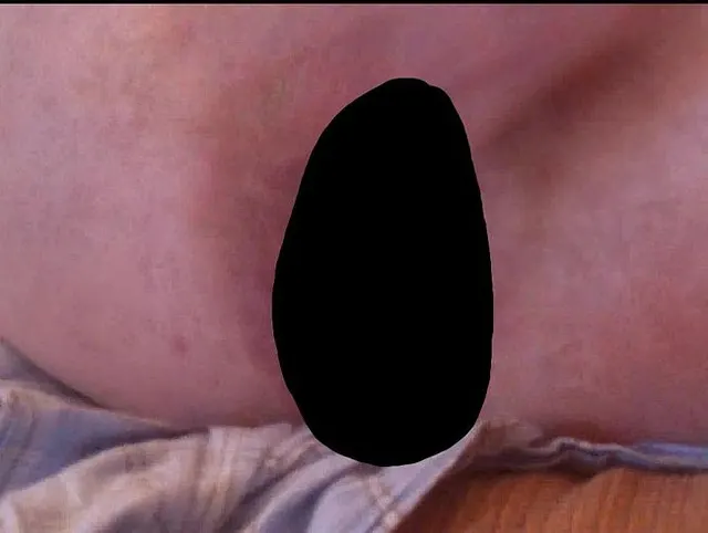 POFotze und Schwanz