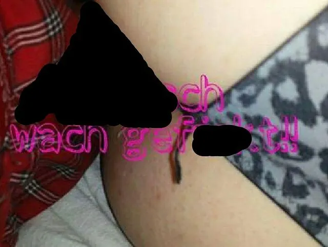 Autsch! Arschwachfick!